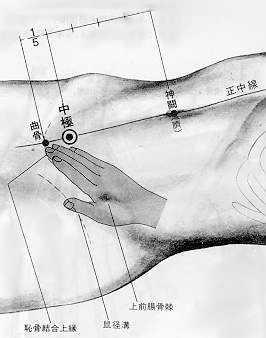 뜸 이미지